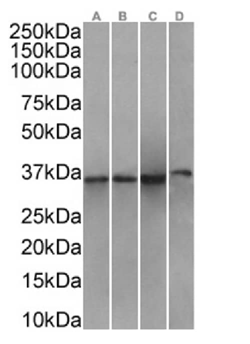 Western Blot: Annexin A1 Antibody (SAIC-13B-19) - Azide and BSA Free [NBP3-20092] - A431(A) (0.1ug/ml), A549(B) (0.1ug/ml), HeLa(C) (0.1ug/ml), and K562(D) (0.3ug/ml) cell lysates (35ug protein in RIPA buffer) were resolved on a SDS PAGE gel and blots were probed with the chimeric rabbit version of SAIC-13B-19 (NBP3-20092), before detection using an anti-rabbit secondary antibody. A primary incubation of 1h was used and protein was detected by chemiluminescence.