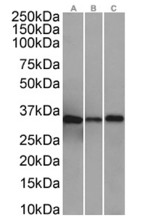 Western Blot: Annexin A4 Antibody (SAIC-14C-10F12) - Azide and BSA Free [NBP3-20093] - HepG2(A) (0.001ug/ml), A431(B) (0.001ug/ml), and HeLa(C) (0.01ug/ml) cell lysates (35ug protein in RIPA buffer) were resolved on a SDS PAGE gel and blots were probed with the chimeric rabbit version of SAIC-14C-10F12 (NBP3-20093), before detection using an anti-rabbit secondary antibody. A primary incubation of 1h was used and protein was detected by chemiluminescence.