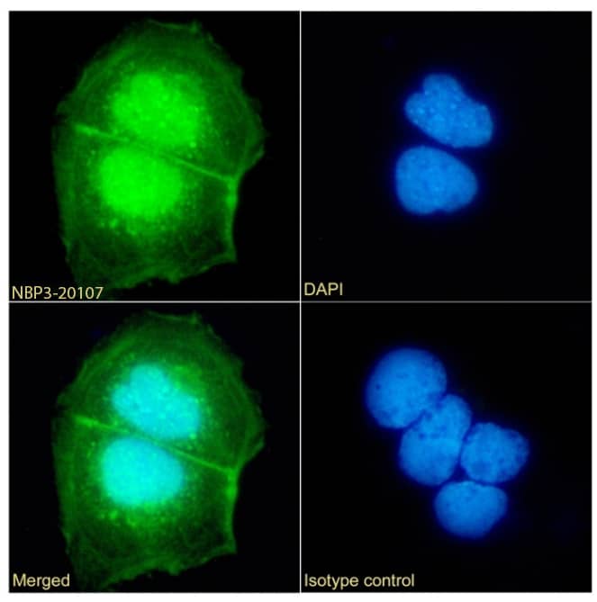 Immunocytochemistry/Immunofluorescence: UbcH10/UBE2C Antibody (SAIC-41A-1) - Azide and BSA Free [NBP3-20107] - Immunofluorescence analysis of paraformaldehyde fixed Caco-2 cells permeabilized with 0.15% Triton stained with the chimeric rabbit IgG version of SAIC-41A-1 (NBP3-20107) (1:100 dilution) for 1h followed by Alexa Fluor(R) 488 secondary antibody (1:1000 dilution), showing NUCLEAR staining. The nuclear stain is DAPI (blue). Panels show from left-right, top-bottom NBP3-20107, DAPI, merged channels and an isotype control. The isotype control was an unknown specificity antibody followed by staining with Alexa Fluor(R) 488 secondary antibody.