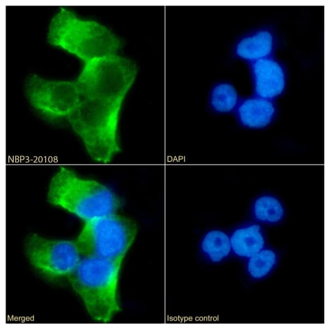 Immunocytochemistry/Immunofluorescence: Serpin A6/Cortisol Binding Globulin Antibody (SAIC-42B-10) - Azide and BSA Free [NBP3-20108] - Immunofluorescence analysis of paraformaldehyde fixed HepG2 cells stained with the chimeric rabbit IgG version of SAIC-42B-10 (NBP3-20108) (1:100 dilution) for 1h followed by Alexa Fluor(R) 488 secondary antibody (1:1000 dilution), showing membrane and cytoplasmic staining. The nuclear stain is DAPI (blue). Panels show from left-right, top-bottom NBP3-20108, DAPI, merged channels and an isotype control. The isotype control was an unknown specificity antibody followed by staining with Alexa Fluor(R) 488 secondary antibody.