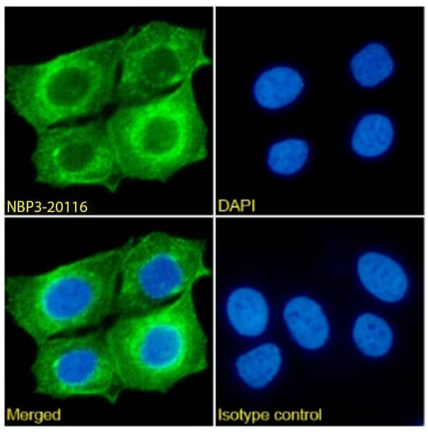 Immunocytochemistry/Immunofluorescence: SLC7A5/LAT1 Antibody (EP3-1) - Chimeric - Azide and BSA Free [NBP3-20116] - Immunofluorescence analysis of paraformaldehyde fixed MCF7 cells stained with the chimeric rabbit IgG version of EP3-1 (NBP3-20116) at 10 ug/ml for 1h followed by Alexa Fluor(R) 488 secondary antibody (2 ug/ml), showing membrane staining. The nuclear stain is DAPI (blue). Panels show from left-right, top-bottom NBP3-20116, DAPI, merged channels and an isotype control. The isotype control was an unknown specificity antibody followed by staining with Alexa Fluor(R) 488 secondary antibody.