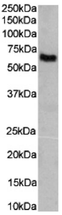 Western Blot: Angiotensin II Antibody (KAA8) - Chimeric - Azide and BSA Free [NBP3-20123] - Human plasma lysates (35ug protein in RIPA buffer) were resolved on a SDS PAGE gel and blots were probed with the chimeric rabbit version of KAA8 (NBP3-20123) at 0.1 ug/ml before detection using an anti-rabbit secondary antibody. A primary incubation of 1h was used and protein was detected by chemiluminescence.