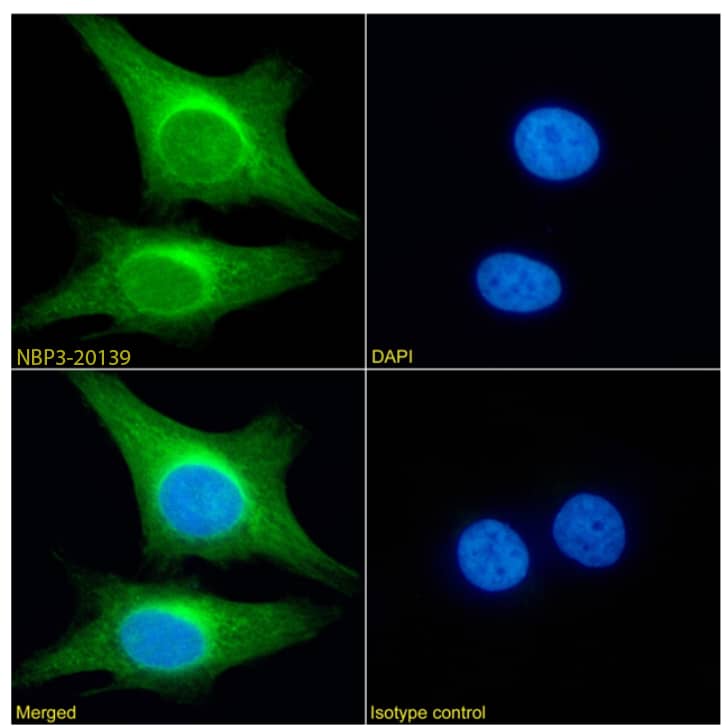 Immunocytochemistry/Immunofluorescence: PRDM4 Antibody (RAB-C367) - Chimeric - Azide and BSA Free [NBP3-20139] - Immunofluorescence analysis of paraformaldehyde fixed HeLa cells permeabilized with 0.15% Triton stained with the chimeric rabbit IgG version of RAB-C367 (NBP3-20139) (1:100 dilution) for 1h followed by Alexa Fluor(R) 488 secondary antibody (1:1500 dilution), showing cytoplasmic staining. The nuclear stain is DAPI (blue). Panels show from left-right, top-bottom NBP3-20139, DAPI, merged channels and an isotype control. The isotype control was an unknown specificity antibody followed by staining with Alexa Fluor(R) 488 secondary antibody.