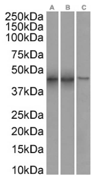 Western Blot: SETD7 Antibody (RAB-C220) - Chimeric - Azide and BSA Free [NBP3-20145] - Nuclear lysate of MCF7(A) (0.01ug/ml), Jurkat(B) (0.1ug/ml) cells and A549(C) (0.03ug/ml) cell lysates (35ug protein in RIPA buffer) were resolved on a SDS PAGE gel and blots were probed with the chimeric rabbit version of RAB-C220 (NBP3-20145) before detection using an anti-rabbit secondary antibody. A primary incubation of 1h was used and protein was detected by chemiluminescence.