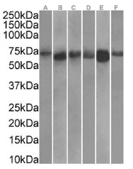 Western Blot: TDRD3 Antibody (RAB-C419) - Chimeric - Azide and BSA Free [NBP3-20149] - Human brain cerebellum(A) (1ug/ml), human skeletal muscle(B) (0.3ug/ml), heart(C) (0.3ug/ml), human placenta(D) (0.1ug/ml), human testes(E) (0.3ug/ml) and human kidney(F) (0.1ug/ml) tissue lysates (35ug protein in RIPA buffer) were resolved on a SDS PAGE gel and blots were probed with the chimeric rabbit version of RAB-C419 (NBP3-20149) before detection using an anti-rabbit secondary antibody. A primary incubation of 1h was used and protein was detected by chemiluminescence.