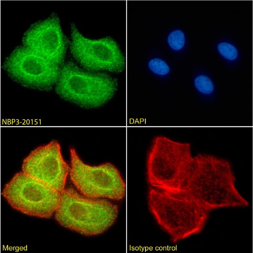 Immunocytochemistry/Immunofluorescence: SUV420H2 Antibody (RAB-C409) - Chimeric - Azide and BSA Free [NBP3-20151] - Immunofluorescence analysis of paraformaldehyde fixed HEK293 cells on Shi-fix(TM) coverslips stained with the chimeric rabbit IgG version of RAB-C409 (NBP3-20151) at 10 ug/ml for 1h followed by Alexa Fluor(R) 488 secondary antibody (2 ug/ml), showing membrane staining. The nuclear stain is DAPI (blue) and the actin stain is phalloidin (red). Panels show from left-right, top-bottom NBP3-20151, DAPI, merged channels and an isotype control. The isotype control was an unknown specificity antibody followed by staining with Alexa Fluor(R) 488 secondary antibody.