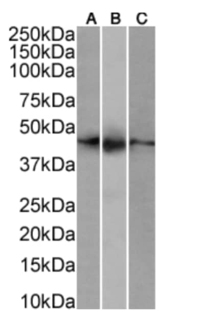 Western Blot: CD161/NK1.1 Antibody (PK-136) - Chimeric - Azide and BSA Free [NBP3-20165] - RAW264.7(A) (1ug/ml) cell lysate, mouse spleen(B) (1ug/ml) and mouse lymph node(C) (0.3ug/ml) tissue lysate (35ug protein in RIPA buffer) were resolved on a SDS PAGE gel and blots were probed with NBP3-20165 before detection using an anti-rabbit secondary antibody. A primary incubation of 1h was used and protein was detected by chemiluminescence.