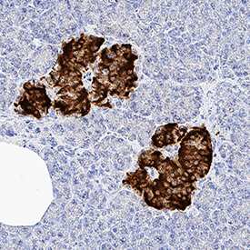 Immunohistochemistry-Paraffin: Pancreatic Cell Marker Antibody Pack [NBP3-20186] - Insulin was detected in immersion fixed paraffin-embedded sections of human pancreas using Rat Anti-Human/Mouse/Bovine Insulin Monoclonal Antibody (Catalog # MAB1417) at 0.5 µg/mL for 1 hour at room temperature followed by incubation with the Anti-Rat IgG VisUCyte™ HRP Polymer Antibody (VC005). Before incubation with the primary antibody, tissue was subjected to heat-induced epitope retrieval using Antigen Retrieval Reagent-Basic (CTS013). Tissue was stained using DAB (brown) and counterstained with hematoxylin (blue). Specific staining was localized to cytoplasm and plasma membrane in islet cells. Staining was performed using our protocol for IHC Staining with VisUCyte HRP Polymer Detection Reagents.