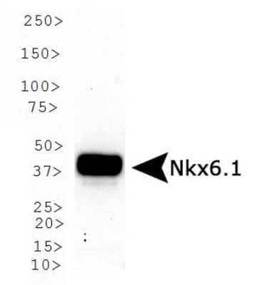  Western Blot: Pancreatic Cell Marker Antibody Pack [NBP3-20186] - Analysis of Nkx6.1 in human skeletal muscle using NKX6.1 Antibody [NBP1-49672].