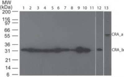 Western Blot: Panoptosome Antibody Pack [NBP3-20189] - Analysis of RIP3 using polyclonal RIPK3/RIP3 antibody [NBP2-24588]. Human tissue blot probed with 5 ug/ml of RIP3 antibody: 1) brain, 2) heart, 3) small intestine, 4) kidney, 5) liver, 6) lung, 7) skeletal muscle, 8) stomach, 9) spleen, 10) ovary, 11) testis, 12) placenta probed at 5 ug/ml, 13) Ramos cell lysate probed at 7 ug/ml. Theoretical molecular weight 56.7 kDa.
