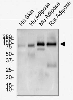 Western Blot: Adipogenesis Antibody Pack [NBP3-20190] - Western Blot: CD36 Antibody [NB400-144] - Total protein from Human Skin and Adipose tissue, Mouse Adipose and Rat Adipose tissue was separated on a 12% gel by SDS-PAGE, transferred to PVDF membrane and blocked in 5% non-fat milk in TBST. The membrane was probed with 2.0 ug/ml anti-CD36 in 5% non-fat milk in TBST and detected with an anti-rabbit HRP secondary antibody using chemiluminescence.