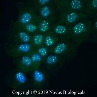 Immunocytochemistry/Immunofluorescence: Parthanatos Antibody Pack [NBP3-20191] - A431 cells were fixed for 10 minutes using 10% formalin and then permeabilized for 5 minutes using 1X PBS + 0.5% Triton-X100.  The cells were incubated with anti-PARP Antibody [NB100-56599] (194C1439) at 5 ug/ml overnight at 4C and detected with an anti-mouse Dylight 488 (Green) at a 1:500 dilution.  Nuclei were counterstained with DAPI (Blue).  Cells were imaged using a 40X objective.