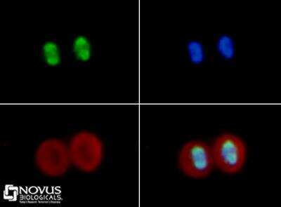 Histone H4 acetyl Lysine 16 was detected in HeLa cells using Rabbit Anti-Human Histone H4 acetyl Lysine 16 Polyclonal Antibody (Catalog # NB21-2077). Cells were stained using a FITC-conjugated Anti-Rabbit IgG Secondary Antibody (green). Nuclei and alpha-tubulin were counterstained with DAPI (blue) and Dylight 550 (red).