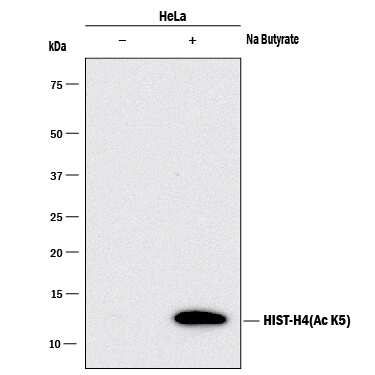 <b>Biological Strategies Validation. </b>Western blot shows lysates of HeLa human cervical epithelial carcinoma cell line untreated (-) or treated (+) with 10mM Sodium (Na) Butyrate for 24 hours. PVDF membrane was probed with 0.1 µg/mL of Rabbit Anti-HumanAcetyl Histone H4 (Lys5) Monoclonal Antibody (Catalog # MAB9549) followed by HRP-conjugated Anti-Rabbit IgG Secondary Antibody (Catalog # HAF008). A specific band was detected for Acetyl Histone H4 (Lys5) at approximately 12 kDa (as indicated). This experiment was conducted under reducing conditions and using Immunoblot Buffer Group 1.