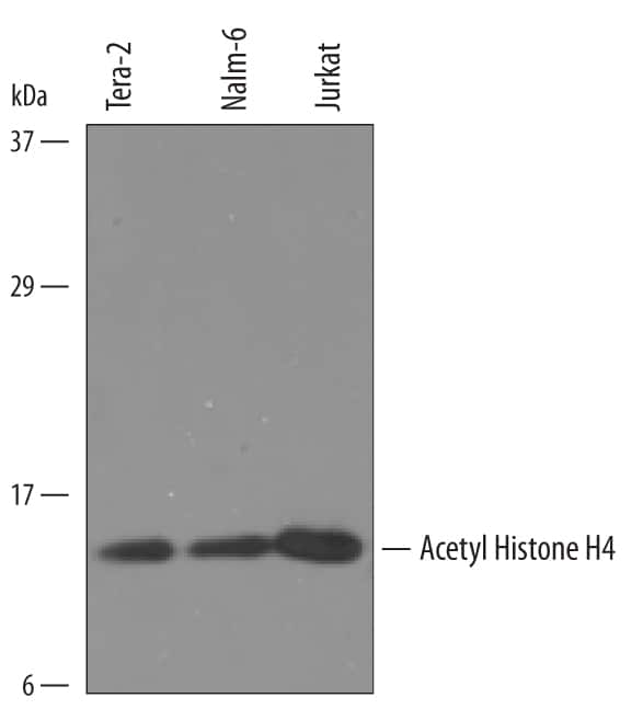 Western blot shows lysates of Tera‑2 human embryonic lung carcinoma cell line, Nalm‑6 human Pre-B acute lymphocytic leukemia cell line, and Jurkat human acute T cell leukemia cell line. PVDF Membrane was probed with 1 µg/mL of Sheep Anti‑Human Acetyl Histone H4 Antigen Affinity-purified Polyclonal Antibody (Catalog # AF5215) followed by HRP-conjugated Anti-Sheep IgG Secondary Antibody (Catalog # HAF016). A specific band was detected for Acetyl Histone H4 at approximately 12 kDa (as indicated). This experiment was conducted under reducing conditions and using Immunoblot Buffer Group 8.