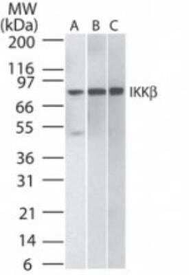 Western blot shows lysates of A) human Daudi, B) HeLa, and C) mouse NIH3T3. PVDF membrane was probed with 1 µg/mL of Mouse Anti-Human IKK beta Protein G purified Monoclonal Antibody (Catalog # NB100-56509) followed by HRP-conjugated Anti-Mouse IgG Secondary Antibody. A specific band was detected for IKK beta at approximately 87 kDa (as indicated). This experiment was conducted under reducing conditions.