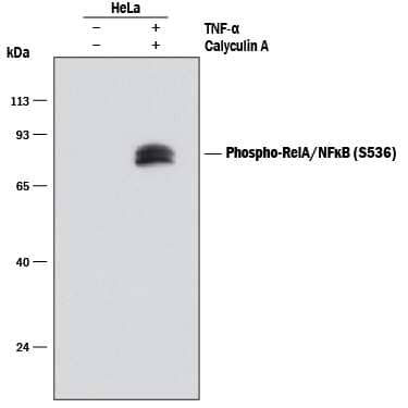 Western blot shows lysates of HeLa human cervical epithelial carcinoma cell line untreated (-) or treated (+) with 100 nM Calyculin A (Catalog # 1336) and 20 ng/mL Recombinant Human TNF-a (Catalog # 210-TA) for 10 minutes. PVDF membrane was probed with 0.1 µg/mL of Rabbit Anti-Human Phospho-RelA/NF kappa B p65 (S536) Monoclonal Antibody (Catalog # MAB72261) followed by HRP-conjugated Anti-Rabbit IgG Secondary Antibody (Catalog # HAF008). A specific band was detected for Phospho-RelA/NF kappa B p65 (S536) at approximately 65 kDa (as indicated). This experiment was conducted under reducing conditions and using Immunoblot Buffer Group 1.