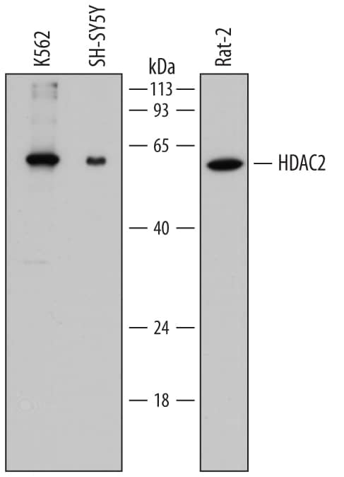 Western blot shows lysates of K562 human chronic myelogenous leukemia cell line, SH-SY5Y human neuroblastoma cell line, and Rat-2 rat embryonic fibroblast cell line. PVDF membrane was probed with 0.2 µg/mL of Mouse Anti-Human Histone Deacetylase 2/HDAC2 Monoclonal Antibody (Catalog # MAB7679) followed by HRP-conjugated Anti-Mouse IgG Secondary Antibody (Catalog # HAF018). A specific band was detected for Histone Deacetylase 2/HDAC2 at approximately 60 kDa (as indicated). This experiment was conducted under reducing conditions and using Immunoblot Buffer Group 1.