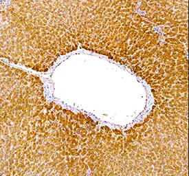 Sirtuin 5/SIRT5 was detected in immersion fixed paraffin-embedded sections of human liver using Sheep Anti-Human Sirtuin 5/SIRT5 Antigen Affinity-purified Polyclonal Antibody (Catalog # AF5914) at 10 µg/mL overnight at 4 °C. Tissue was stained using the Anti-Sheep HRP-DAB Cell & Tissue Staining Kit (brown; Catalog # CTS019) and counterstained with hematoxylin (blue). Specific staining was localized to hepatocyte cytoplasm. View our protocol for Chromogenic IHC Staining of Paraffin-embedded Tissue Sections.