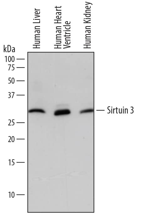 Western blot shows lysates of human liver tissue, human heart ventricle tissue, and human kidney tissue. PVDF membrane was probed with 2 µg/mL of Mouse Anti-Human Sirtuin 3/SIRT3 Monoclonal Antibody (Catalog # MAB7488) followed by HRP-conjugated Anti-Mouse IgG Secondary Antibody (Catalog # HAF018). A specific band was detected for Sirtuin 3/SIRT3 at approximately 28 kDa (as indicated). This experiment was conducted under reducing conditions and using Immunoblot Buffer Group 1.