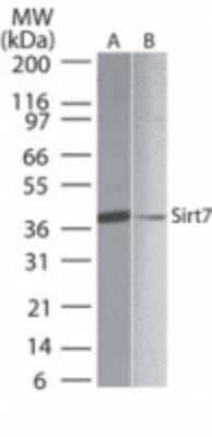 Analysis of SIRT7 in A) human liver and B) PBMC lysate using this antibody at 1 ug/ml.Western blot shows lysates of A) human liver and B) PBMC lysate. PVDF membrane was probed with 1 µg/mL of SIRT7 Polyclonal Antibody (Catalog # NB100-56364) followed by HRP-conjugated Anti-Rabbit IgG Secondary Antibody. A specific band was detected for SIRT7 at approximately 40 kDa (as indicated). 