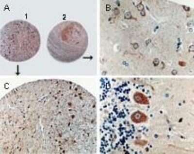 Sections from a brain tissue array stained for Caspase-8 expression using NB100-56116 at 1:2000. A. Normal brain stem (1) and cortex (2). B. Higher magnification of cortex (from A). C. Higher magnification of brain stem (from A). D. Normal cerebellum showing caspase-8 staining in the Purkinge cells.