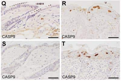 Caspase-9 was detected in paraffin-embedded sections of mouse skin using Caspase-9 polyclonal antibody (NB100-56118). Mice with two different spontaneous mutant alleles of Sharpin show variations in onset of CPDM phenotype. However, the onset is much more rapid in Sharpincpdm-Dem mice as evidenced by antibody detection of cleaved CASPASE 9 (T) when compared to Sharpincpdm mutants (R) or WT mice (Q,S). . Image collected and cropped by CiteAb from the following publication (//doi.org/10.1371/journal.pone.0085666) licensed under a CC-BY license.