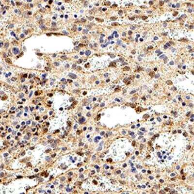 Caspase 10 was detected in immersion fixed paraffin-embedded sections of human spleen using Rabbit Anti-Human Caspase 10 polyclonal Antibody (Catalog # NB100-56125) at 1:1000 for 1 hour at room temperature followed by incubation with the Anti-Rabbit IgG VisUCyte™ HRP Polymer Antibody (Catalog # VC003). Tissue was stained using DAB (brown) and counterstained with hematoxylin (blue). Specific staining was localized to the cytoplasm and plasma membrane in splenocytes