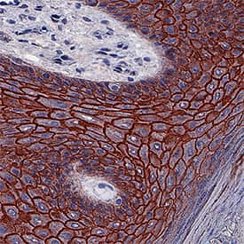 Desmoglein-1 was detected in immersion fixed paraffin-embedded sections of human skin hyperplasia using Mouse Anti-Human Desmoglein-1 Monoclonal Antibody (Catalog # MAB944) at 5 µg/mL for 1 hour at room temperature followed by incubation with the Anti-Mouse IgG VisUCyte™ HRP Polymer Antibody (Catalog # VC001). Tissue was stained using DAB (brown) and counterstained with hematoxylin (blue). Specific staining was localized to keratinocyte membranes. View our protocol for IHC Staining with VisUCyte HRP Polymer Detection Reagents.