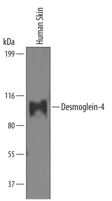 Western blot shows lysates of human skin tissue. PVDF Membrane was probed with 0.1 µg/mL of Human Desmoglein-4 Antigen Affinity-purified Polyclonal Antibody (Catalog # AF6589) followed by HRP-conjugated Anti-Sheep IgG Secondary Antibody (Catalog # HAF016). A specific band was detected for Desmoglein-4 at approximately 100-110 kDa (as indicated). This experiment was conducted under reducing conditions and using Immunoblot Buffer Group 1.