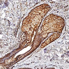 Desmocollin-1 was detected in perfusion fixed frozen sections of mouse skin using Rat Anti-Human/Mouse Desmocollin-1 Monoclonal Antibody (Catalog # MAB7367) at 1.7 µg/mL overnight at 4 °C. Tissue was stained using the Anti-Rat HRP-DAB Cell & Tissue Staining Kit (brown; Catalog # CTS017) and counterstained with hematoxylin (blue). Specific staining was localized to hair root sheath. View our protocol for Chromogenic IHC Staining of Frozen Tissue Sections.