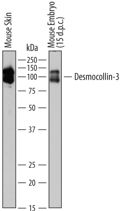 Western blot shows lysates of mouse skin tissue and mouse embryo (15 d.p.c.) tissue. PVDF membrane was probed with 1 µg/mL of Rat Anti-Mouse Desmocollin-3 Monoclonal Antibody (Catalog # MAB7265) followed by HRP-conjugated Anti-Rat IgG Secondary Antibody (Catalog # HAF005). Specific bands were detected for Desmocollin-3 at approximately 95-110 kDa (as indicated). This experiment was conducted under reducing conditions and using Immunoblot Buffer Group 1.