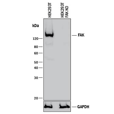 <b>Genetic Strategies Validation. </b>Western blot shows lysates of HEK293T human embryonic kidney parental cell line and FAK knockout HEK293T cell line (KO). PVDF membrane was probed with 1 µg/mL of Sheep Anti-Human/Mouse/Rat FAK Antigen Affinity-purified Polyclonal Antibody (Catalog # AF4467) followed by HRP-conjugated Anti-Sheep IgG Secondary Antibody (Catalog # HAF016). A specific band was detected for FAK at approximately 135 kDa (as indicated) in the parental HEK293T cell line, but is not detectable in knockout HEK293T cell line. GAPDH (Catalog # AF5718) is shown as a loading control. This experiment was conducted under reducing conditions and using Immunoblot Buffer Group 1.