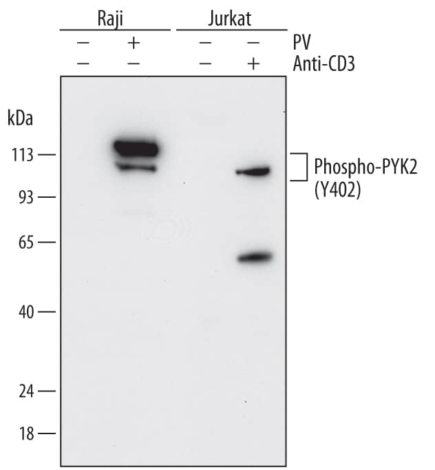 <b>Biological Strategies Validation. </b>Western blot shows lysates of Raji human Burkitt's lymphoma cell line and Jurkat human acute T cell leukemia cell line untreated (-) or treated (+) with 1 mM Pervanadate (PV) for 30 minutes and 10 µg/mL Mouse Anti-Human CD3e Monoclonal Antibody (Catalog # MAB100) for 15 minutes. PVDF membrane was probed with 0.5 µg/mL of Mouse Anti-Human Phospho-PYK2/FAK2 (Y402) Monoclonal Antibody (Catalog # MAB6210) followed by HRP-conjugated Anti-Mouse IgG Secondary Antibody (Catalog # HAF018). Specific bands were detected for Phospho-PYK2/FAK2 (Y402) at approximately 105-115 kDa (as indicated). This experiment was conducted under reducing conditions and using Immunoblot Buffer Group 1.