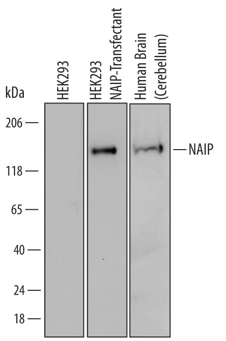 Western blot shows lysates of HEK293 human embryonic kidney cell line either mock transfected or transfected with human NAIP and human brain (cerebellum) tissue. PVDF Membrane was probed with 1 µg/mL of Human NAIP Monoclonal Antibody (Catalog # MAB829) followed by HRP-conjugated Anti-Mouse IgG Secondary Antibody (Catalog # HAF007). A specific band was detected for NAIP at approximately 160 kDa (as indicated). This experiment was conducted under reducing conditions and using Immunoblot Buffer Group 2.