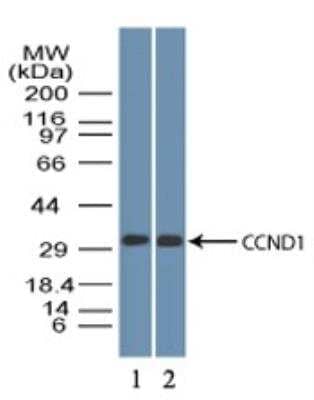 Western blot shows lysates of 1) mouse C2C12 and 2) mouse NIH 3T3 lysate. PVDF membrane was probed with 5 µg/mL of Rabbit Anti-Human Cyclin D1 Polyclonal Antibody (Catalog # NBP2-24695) followed by HRP-conjugated Anti-Rabbit IgG Secondary Antibody. This experiment was conducted under reducing conditions. PicoTect ECL substrate solution were used for this test.
