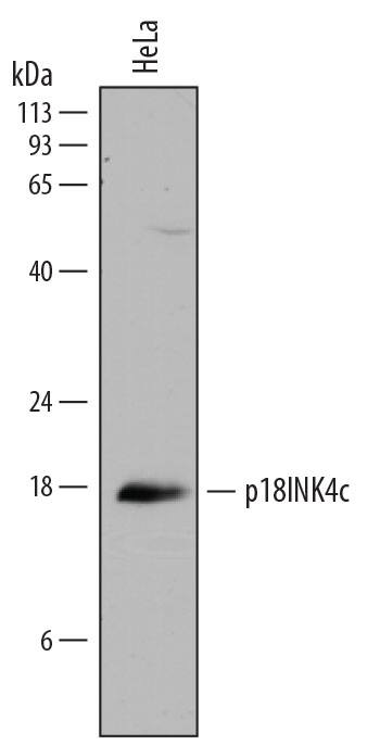 Western blot shows lysates of HeLa human cervical epithelial carcinoma cell line. PVDF membrane was probed with 0.5 µg/mL of Goat Anti-Human p18INK4c/CDKN2C Antigen Affinity-purified Polyclonal Antibody (Catalog # AF7746) followed by HRP-conjugated Anti-Goat IgG Secondary Antibody (Catalog # HAF017). A specific band was detected for p18INK4c/CDKN2C at approximately 18 kDa (as indicated). This experiment was conducted under reducing conditions and using Immunoblot Buffer Group 1.