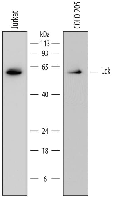 Western blot shows lysates of Jurkat human acute T cell leukemia cell line and COLO 205 human colorectal adenocarcinoma cell line. PVDF membrane was probed with 0.2 µg/mL of Mouse Anti-Human Lck Monoclonal Antibody (Catalog # MAB37041) followed by HRP-conjugated Anti-Mouse IgG Secondary Antibody (HAF007). A specific band was detected for Lck at approximately 56 kDa (as indicated). This experiment was conducted under reducing conditions and using Immunoblot Buffer Group 1.