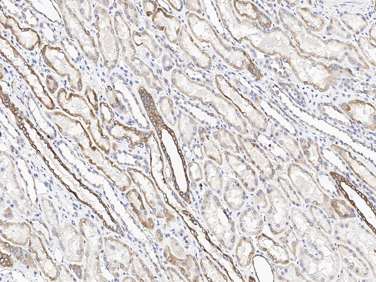 Immunohistochemistry-Paraffin: CH25H Antibody [NBP3-20218] - Immunochemical staining of human CH25H in human kidney with NBP3-20218 at 1:100 dilution, formalin-fixed paraffin embedded sections.