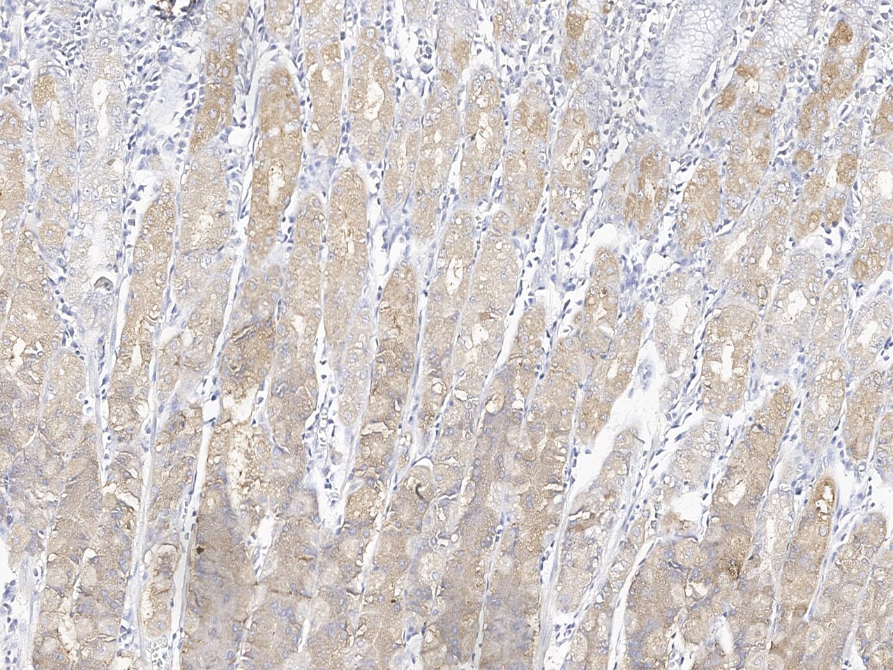 Immunohistochemistry-Paraffin: ALG13 Antibody [NBP3-20219] - Immunochemical staining of human ALG13 in human stomach with NBP3-20219 at 1:100 dilution, formalin-fixed paraffin embedded sections.