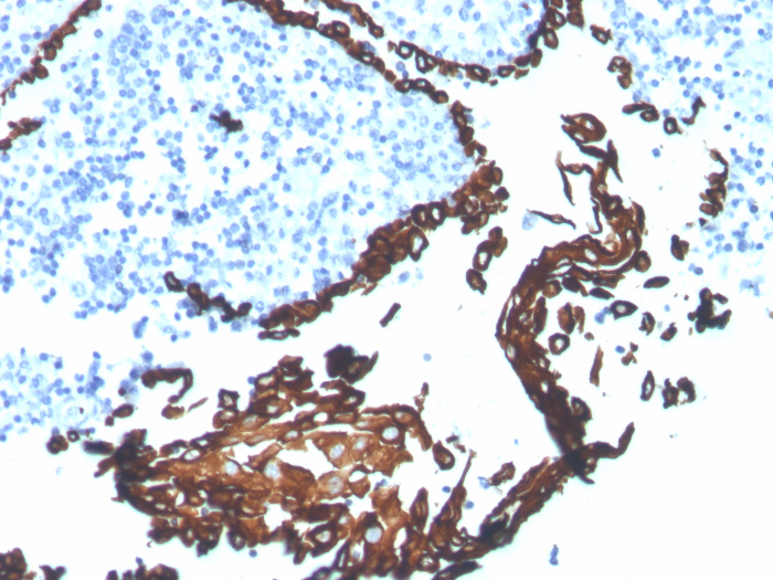 Formalin-fixed, paraffin-embedded human tonsil stained with Cytokeratin 5 antibody (KRT5/7500R). HIER: Tris/EDTA, pH9.0, 45min. Secondary: HRP-polymer, 30min. DAB, 5min.