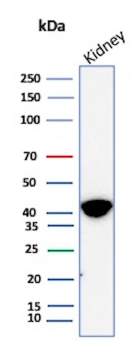 Western Blot Analysis of human kidney tissue lysate using alpha-Methylacyl-CoA Racemase/AMACR Antibody (AMACR/8350R).