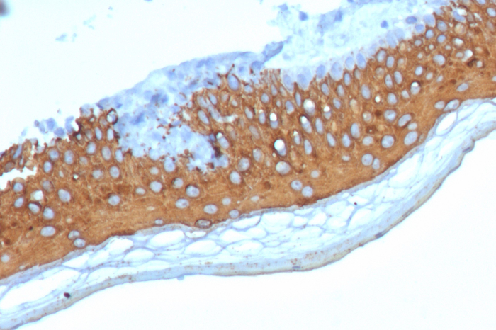 IHC analysis of formalin-fixed, paraffin-embedded human skin. Stained using Cytokeratin 10 antibody (KRT10/7804R) at 2ug/ml in PBS for 30min RT. HIER: Tris/EDTA, pH9.0, 45min. Secondary: HRP-polymer, 30min. DAB, 5min.