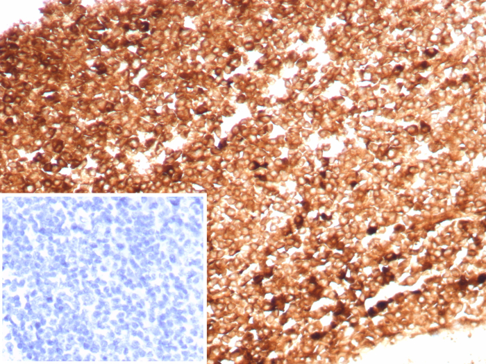 Formalin-fixed, paraffin-embedded human tonsil stained with Ferritin Heavy Chain antibody (FTH/8700R). HIER: Tris/EDTA, pH9.0, 45min. Secondary: HRP-polymer, 30min. DAB, 5min.