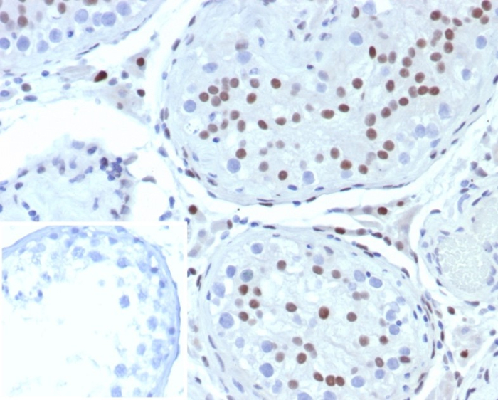 Formalin-fixed, paraffin-embedded human testis stained with SF-1/NR5A1/Steroidogenic Factor 1 antibody (SF1/8000R). Inset: PBS instead of primary antibody; secondary only negative control.