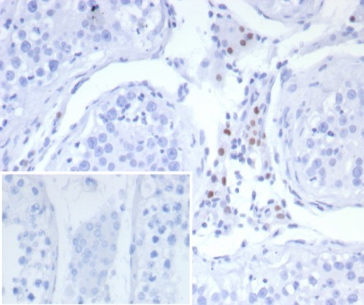 Formalin-fixed, paraffin-embedded human testis stained with SF-1/NR5A1/Steroidogenic Factor 1 antibody (SF1/8150R). Inset: PBS instead of primary antibody; secondary only negative control.