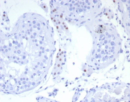 Formalin-fixed, paraffin-embedded human testis stained with SF-1/NR5A1/Steroidogenic Factor 1 antibody (SF1/8150R). HIER: Tris/EDTA, pH9.0, 45min. Secondary: HRP-polymer, 30min. DAB, 5min.