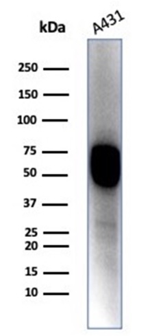 Western blot analysis of A431 cell lysate using Cytokeratin 14 antibody (KRT14/4128).