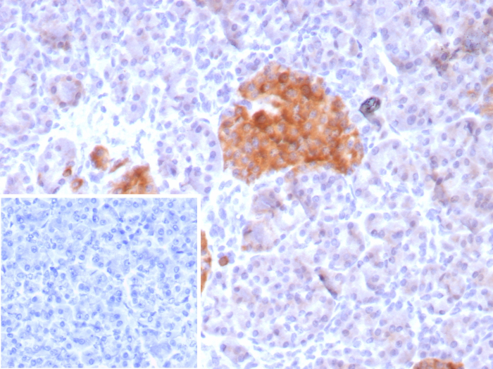 Formalin-fixed, paraffin-embedded human pancreas stained with GAD2/GAD65 antibody (GAD2/8547R). HIER: Tris/EDTA, pH9.0, 45min. Secondary: HRP-polymer, 30min. DAB, 5min.