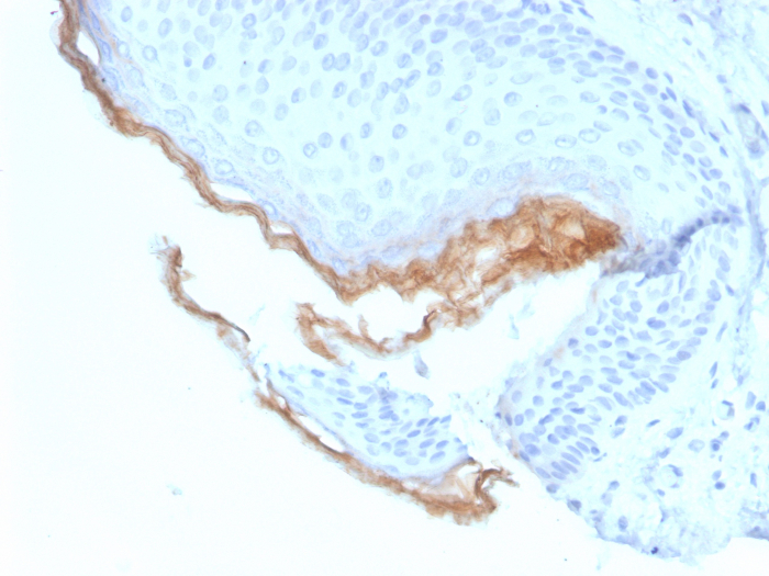 Formalin-fixed, paraffin-embedded human skin stained with Kallikrein 5 antibody (KLK5/3844).